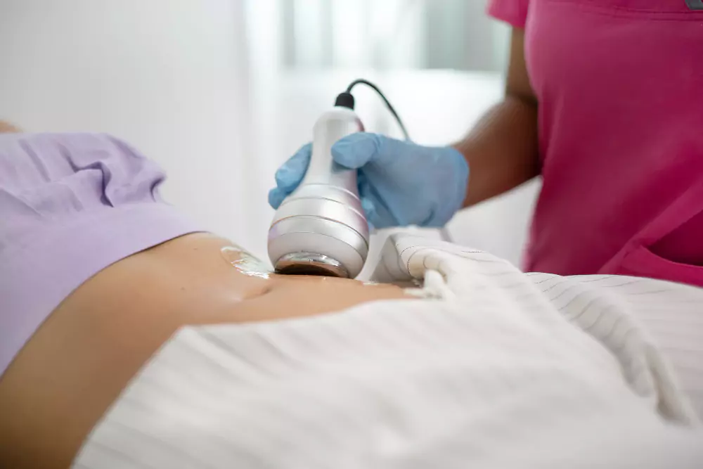RF Body Contouring