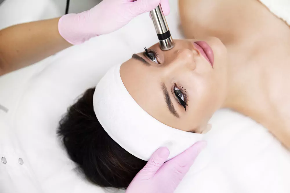 Microdermabrasion